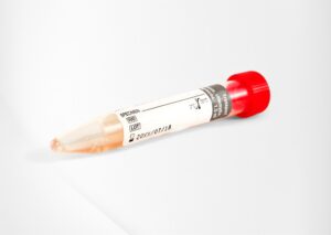Diagnostics - Sample Blood Test Tubes