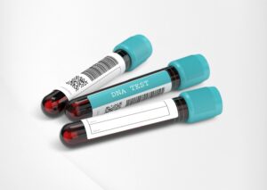Diagnostics - Vials