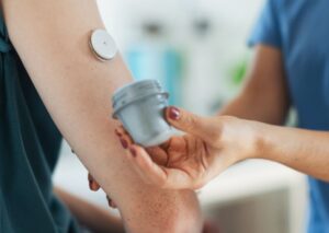 On-Body Devices - Glucose Monitor
